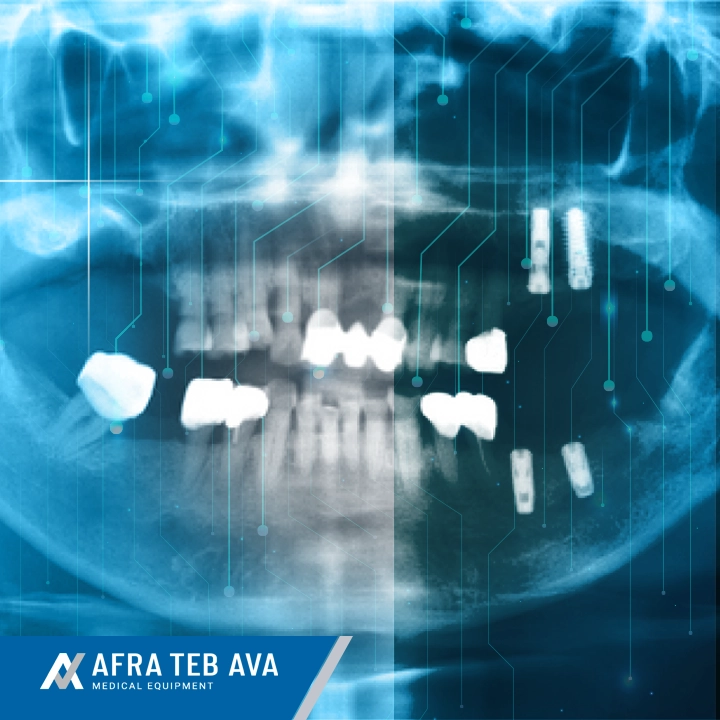 Horizontal left side