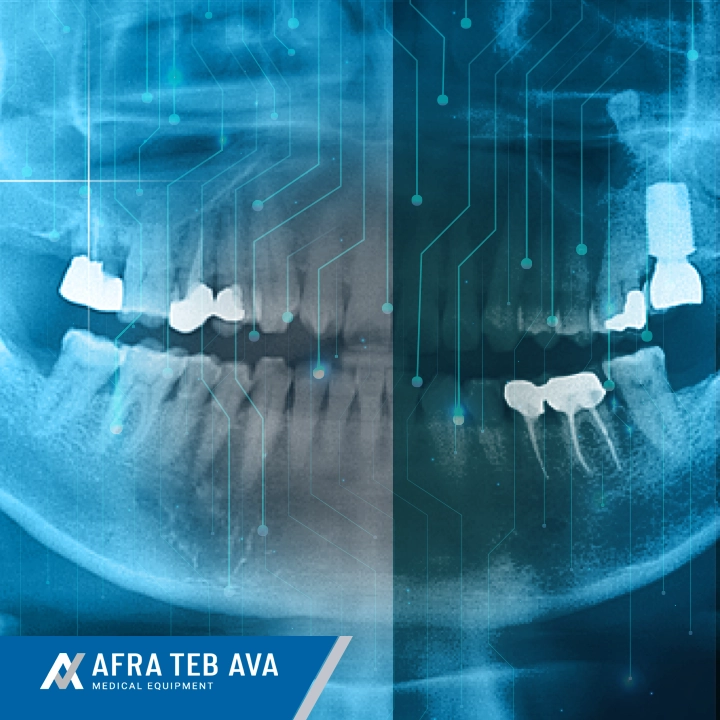 Sinus Augmentation 10