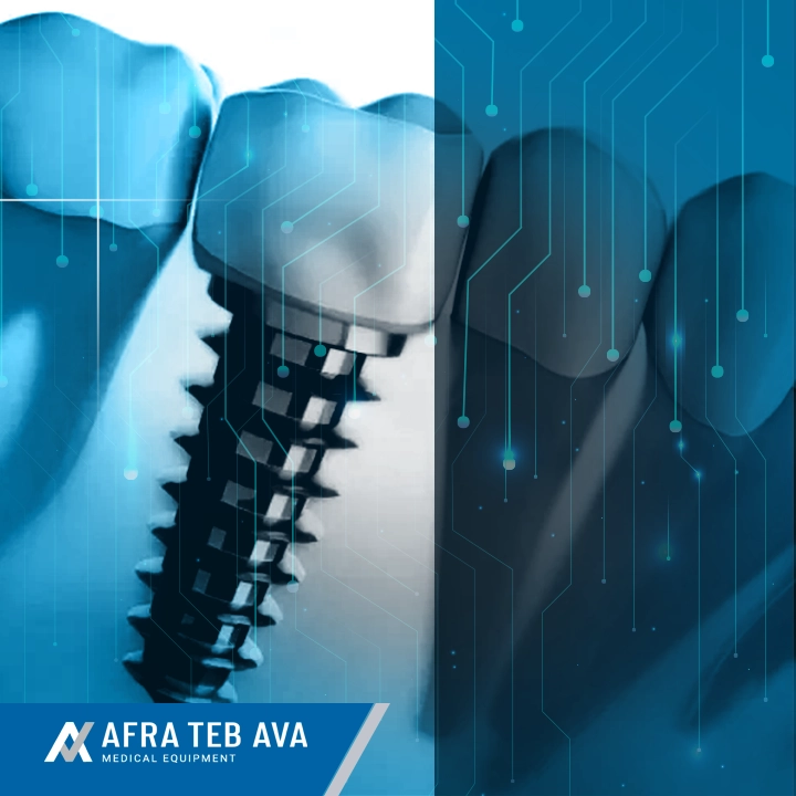 خرید ایمپلنت دندان کره‌ای در تهران