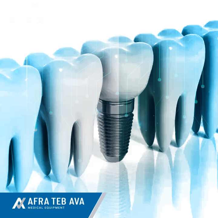 مقایسه ایمپلنت‌های دندانی از برندهای مختلف