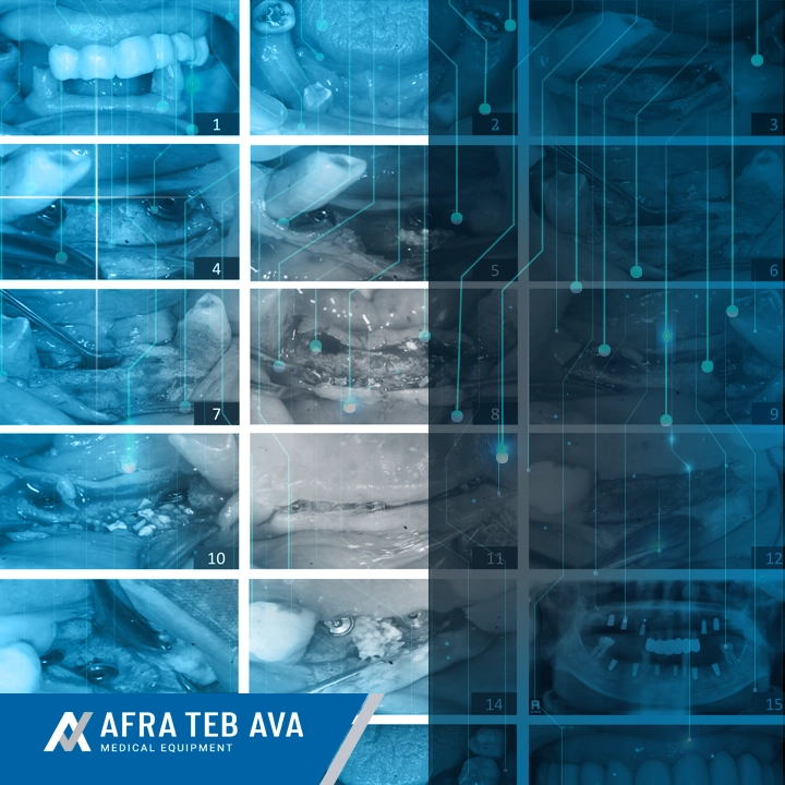 Clinical Cases Reconstructive Implantology