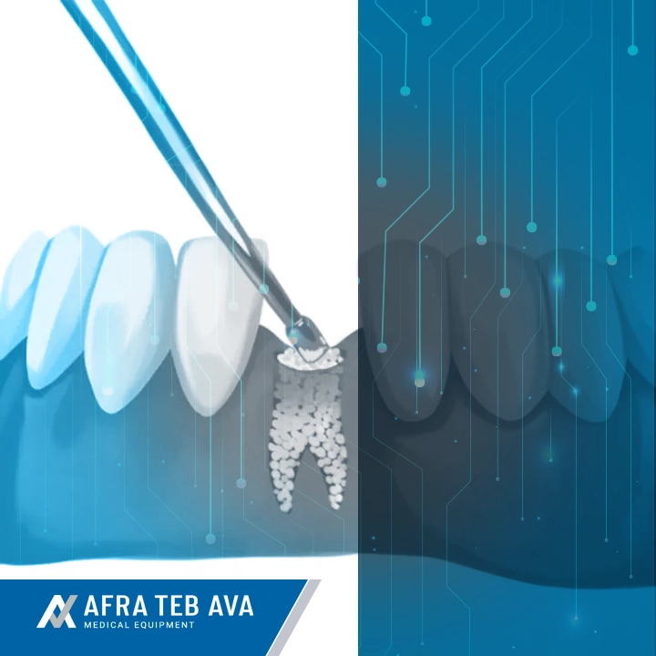 dental powder implant injection